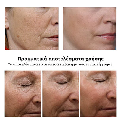 Mamushi ARG® Cream 50ml - Botox Effect Κρέμα με Argireline