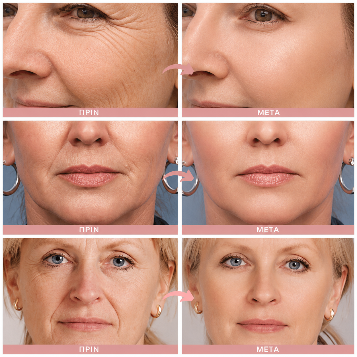 Mamushi ARG® Mask 30 ml - Botox Effect Μάσκα νύχτας με Argireline
